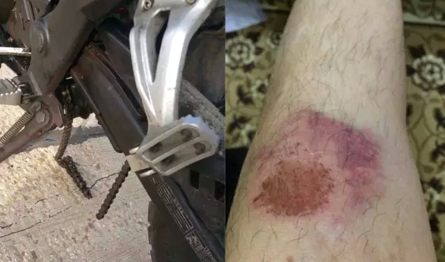 摩托车链条损坏是途中最常见的故障。在山路上骑车，一不小心就会摔倒造成严重擦伤。
